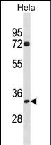 WB - TIPIN Antibody(N-term) AP19596a