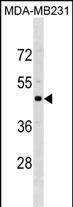 CCR5 Antibody (Center) (Cat. #AP19617c) western blot analysis in MDA-MB231 cell line lysates (35ug/lane).This demonstrates the CCR5 antibody detected the CCR5 protein (arrow).