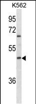 ABO Antibody (N-term)(Ascites)(Cat. #AM2158a) western blot analysis in K562 cell line lysates (35?g/lane).This demonstrates the ABO antibody detected the ABO protein (arrow).