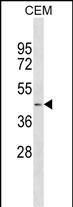 AGT Antibody (N-term) (Cat. #AM2173b) western blot analysis in CEM cell line lysates (35?g/lane).This demonstrates the AGT antibody detected the AGT protein (arrow).