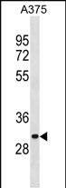 WB - ARMCX6 Antibody(N-term) AP19653a