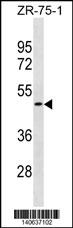 WB - OR1S2 Antibody(C-term) AP19686b