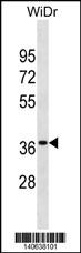 WB - OR6K3 Antibody(N-term) AP19687a