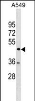 WB - TSPYL1 Antibody(C-term) AP19691b