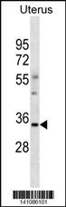 WB - OR6S1 Antibody(C-term) AP19721b