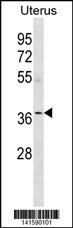 WB - OR5W2 Antibody(C-term) AP19736b
