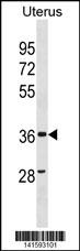 WB - ZC3HAV1L Antibody(C-term) AP19737b