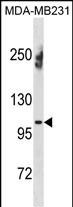 ENPP1 Antibody (N-term) (Cat. #AP19744a) western blot analysis in MDA-MB231 cell line lysates (35ug/lane).This demonstrates the ENPP1 antibody detected the ENPP1 protein (arrow).