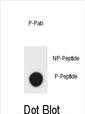 Dot blot analysis of mouse ERBB2 Antibody (Phospho S1051) Phospho-specific Pab (Cat. #AP3798a) on nitrocellulose membrane. 50ng of Phospho-peptide or Non Phospho-peptide per dot were adsorbed. Antibody working concentrations are 0.6ug per ml.