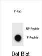 Dot blot analysis of ULK2 Antibody (Phospho S323) Phospho-specific Pab (Cat. #AP3806a) on nitrocellulose membrane. 50ng of Phospho-peptide or Non Phospho-peptide per dot were adsorbed. Antibody working concentrations are 0.6ug per ml.