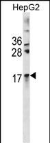 CRYAA Antibody (Center) (Cat. #AP19751c) western blot analysis in HepG2 cell line lysates (35ug/lane).This demonstrates the CRYAA antibody detected the CRYAA protein (arrow).