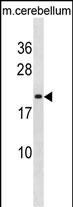WB - LIN7B Antibody (N-term) AP19782a