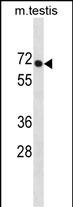 WB - PLD3 Antibody(N-term) AP19786a