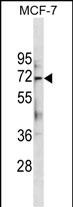 ATG13 Antibody (Center S355.) (Cat. #AP19789c) western blot analysis in MCF-7 cell line lysates (35ug/lane).This demonstrates the ATG13 antibody detected the ATG13 protein (arrow).