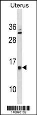 WB - GALNTL5 Antibody(N-term) AP19796a