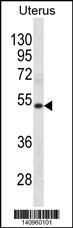 WB - KRT72 Antibody(Center) AP19811c