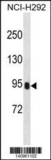 WB - PRSS36 Antibody(Center) AP19812c