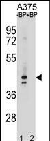 WB - OR5AC2 Antibody(C-term) AP19866b