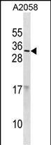 WB - RNASE9 Antibody(C-term) AP19867b