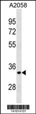 WB - ELOVL3 Antibody(C-term) AP19871b