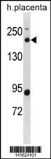 WB - BCL9L Antibody(N-term) AP19875a