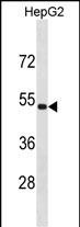 WB - ZNF773 Antibody(N-term) AP19876a