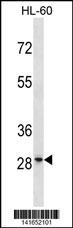 WB - GRRP1 Antibody(C-term) AP19878B