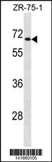 WB - UGT2B28 Antibody(Center) AP19881c