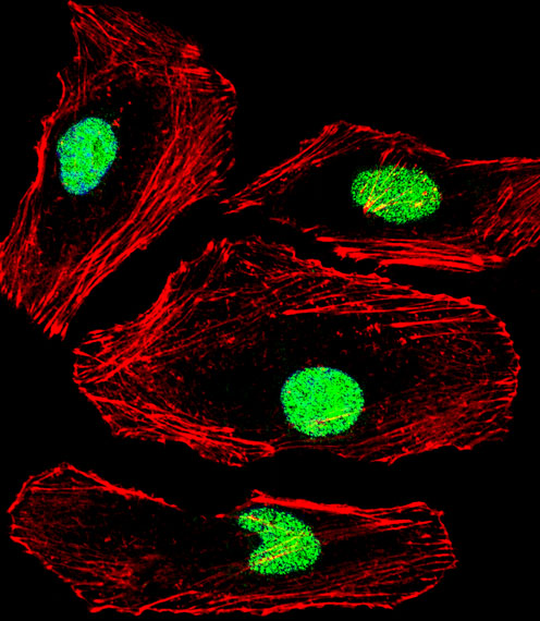 Fluorescent confocal image of Hela cell stained with MBD2 Antibody (Center)(Cat#AP19883c).Hela cells were fixed with 4% PFA (20 min), permeabilized with Triton X-100 (0.1%, 10 min), then incubated with MBD2 primary antibody (1:25, 1 h at 37?). For secondary antibody, Alexa Fluor� 488 conjugated donkey anti-rabbit antibody (green) was used (1:400, 50 min at 37?).Cytoplasmic actin was counterstained with Alexa Fluor� 555 (red) conjugated Phalloidin (7units/ml, 1 h at 37?). Nuclei were counterstained with DAPI (blue) (10 �g/ml, 10 min).MBD2 immunoreactivity is localized to Nucleus significantly.