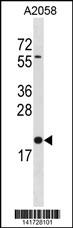 WB - BLOC1S3 Antibody (C-term) AP19902B