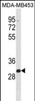 WB - ZNF367 Antibody (C-term) AP19915b