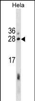 EBAG9 Antibody (Center) (Cat. #AP19925c) western blot analysis in Hela cell line lysates (35ug/lane).This demonstrates the EBAG9 antibody detected the EBAG9 protein (arrow).