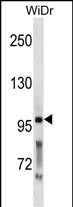 WB - PCSK5 Antibody (N-term) AP19980a