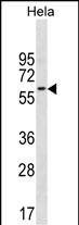 CD3EAP Antibody (N-term) (Cat. #AP19997a) western blot analysis in Hela cell line lysates (35ug/lane).This demonstrates the CD3EAP antibody detected the CD3EAP protein (arrow).