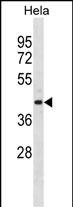 ADPRH Antibody (C-term) (Cat. #AP20001b) western blot analysis in Hela cell line lysates (35ug/lane).This demonstrates the ADPRH antibody detected the ADPRH protein (arrow).