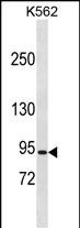 WB - CLCN5 Antibody (N-term) AP20002a