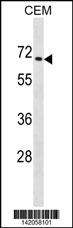 WB - ZNF93 Antibody (N-term) AP20006a