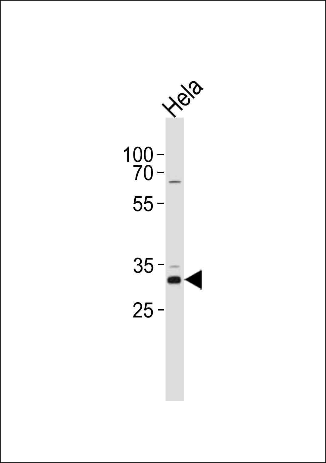 CCND1 Antibody (T288) (Cat. #AP20024b) western blot analysis in Hela cell line lysates (35ug/lane).This demonstrates the CCND1 antibody detected the CCND1 protein (arrow).
