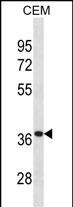WB - TTPA Antibody (Center) AP20030c