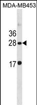 CLDN14 Antibody (C-term) (Cat. #AP20035b) western blot analysis in MDA-MB453 cell line lysates (35ug/lane).This demonstrates the CLDN14 antibody detected the CLDN14 protein (arrow).