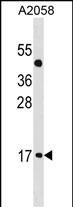 ATOH7 Antibody (Center) (Cat. #AP20067c) western blot analysis in A2058 cell line lysates (35ug/lane).This demonstrates the ATOH7 antibody detected the ATOH7 protein (arrow).