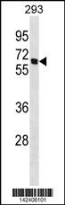 WB - CHRNB4 Antibody (C-term) AP20082b