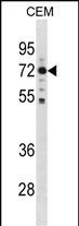 WB - MAK Antibody (C-term) AP20087b