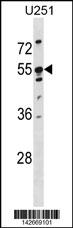 WB - KRT86 Antibody (Center) AP20108c