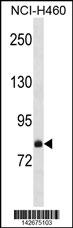 WB - FCSD2 Antibody (C-term) AP20110b