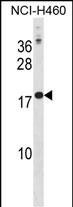 CSH1 Antibody (N-term) (Cat. #AP20176a) western blot analysis in NCI-H460 cell line lysates (35ug/lane).This demonstrates the CSH1 antibody detected the CSH1 protein (arrow).