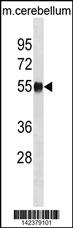 WB - Mouse Ppm1h Antibody (Center) AP20216c