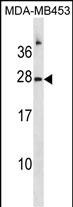 WB - RNASE1 Antibody (N-term) AP20222a