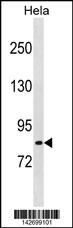 WB - LRCH1 Antibody (Center) AP20249c