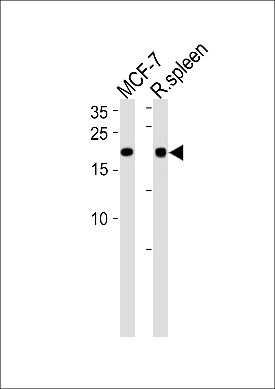 CNBP Antibody (Center) (Cat. #AP20285c) western blot analysis in MCF-7 cell line and rat spleen tissue lysates (35ug/lane).This demonstrates the CNBP antibody detected the CNBP protein (arrow).
